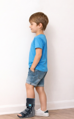 מגף הליכה מתנפח לילדים אורתופדי – קיבוע והגנה לאחר ניתוח | Air Walker