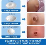 ⁦חגורת בקע טבורי לתינוק (הרניה Hernia) – חגורת תמיכה וייצוב לבטן⁩ – תמונה ⁦2⁩