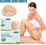 ⁦רצועת סיליקון להפחתת צלקות anti scar, שיפור מראה צלקת ועור והחלמה מהירה⁩ – תמונה ⁦2⁩