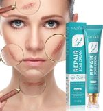 קרם סיליקון להפחתת צלקות anti scar, שיפור מראה צלקת ועור והחלמה מהירה