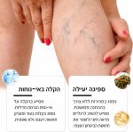 ⁦קרם וריקוזה לרגליים Varicose Cream – להקלה על דליות, ורידי עכביש, כאבים, כבדות והתכווצויות⁩ – תמונה ⁦4⁩