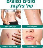 ⁦תרסיס מתקדם לטיפול בצלקות – Scar Spray להפחתת מראה צלקות וסימנים בעור⁩ – תמונה ⁦4⁩